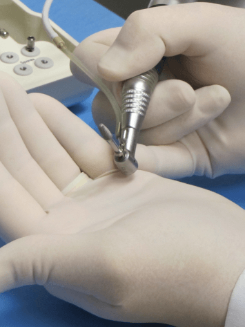 Two hands wearing white gloves holding a dental instrument